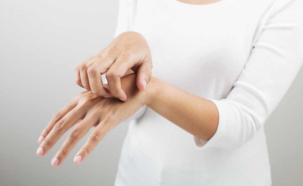 La Dermatite Atopica